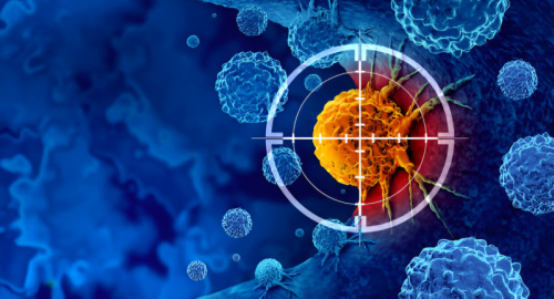 Stress Intrinseco ed Estrinseco nel Microambiente Tumorale: Una Prospettiva Sull'Impatto sull'Immunit